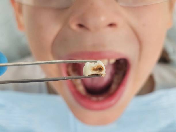 Best Pediatric Emergency Dentist in Weston, FL