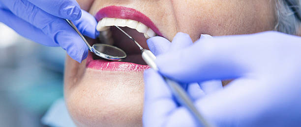 Best Broken or Cracked Tooth Emergency Dentist in Weston, FL